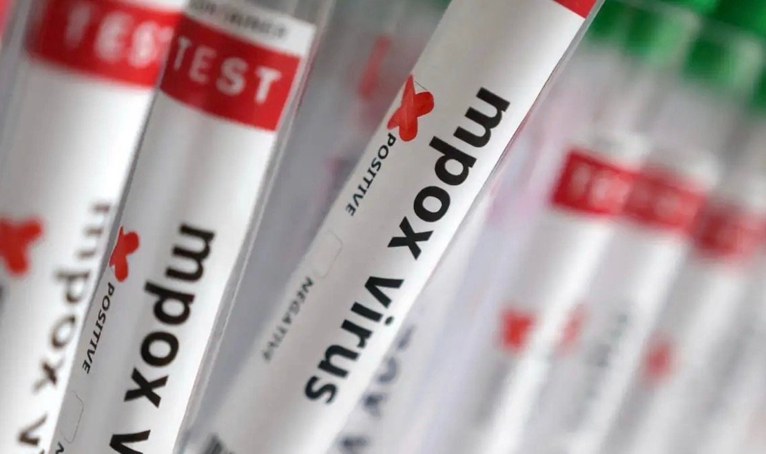 Sobe para 140 número de casos confirmados de Mpox no país, em 2026